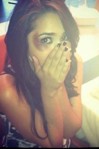 imundefeated:  “When Jinsu throw his phone at jasmine and cracked her head she needed stitches and lied that she hit it on a table ” She put a smile on her face everyday, and they even looked happy together.. Poor Jasmine. Stay strong!