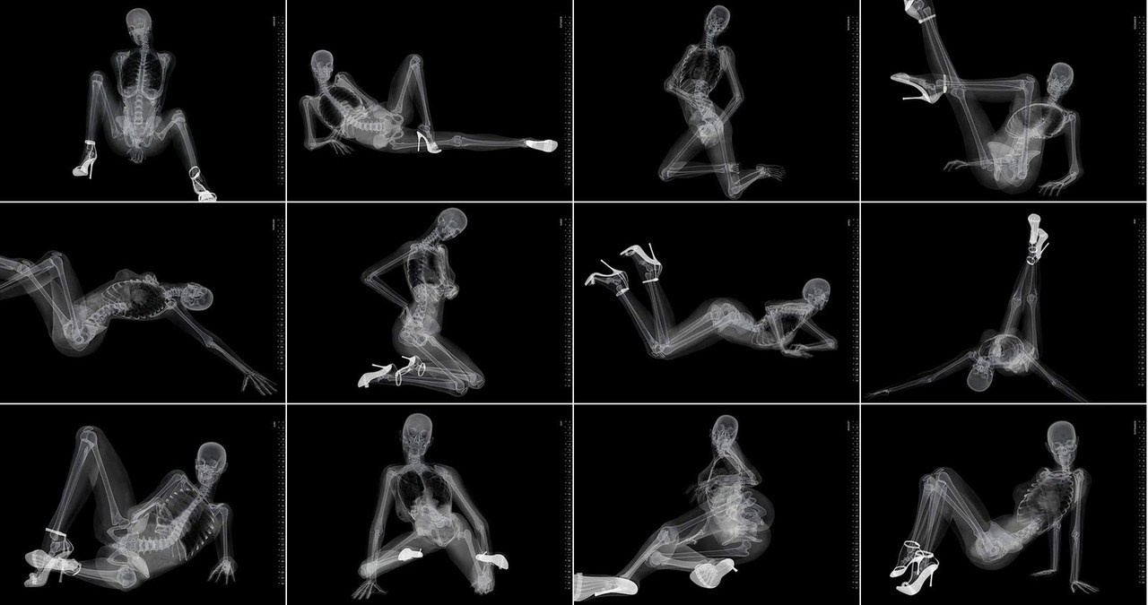 x-ray beauty