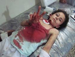 Ghalebsarmini:  That’s A Young Girl From Homs - Syria ,  The Regime Killed Her