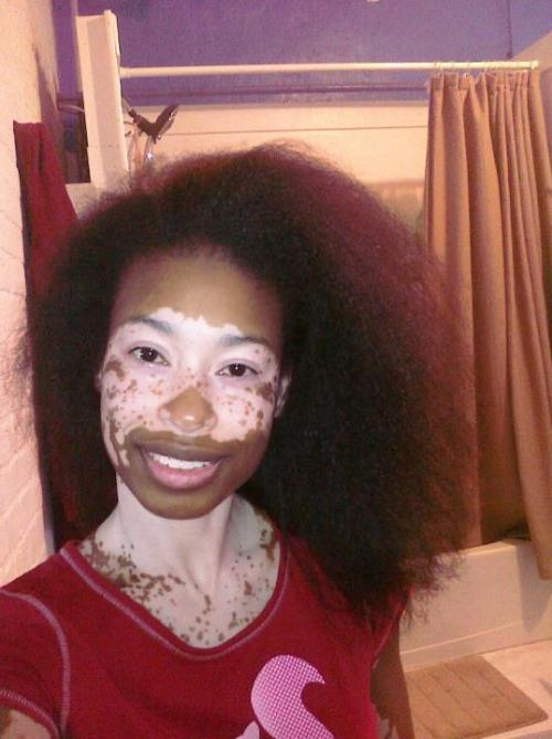 disabledpeoplearesexy:  Just had to find some more pictures of the beautiful Sembene McFarland.  goi