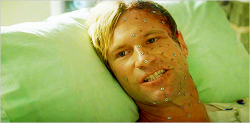 breathy:  Before and after shots of Harvey Dent, Two-Face, in The Dark Knight 