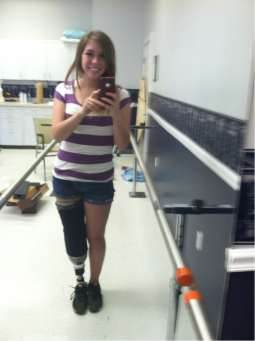 kerrymooner:  Temporary prosthesis! :))