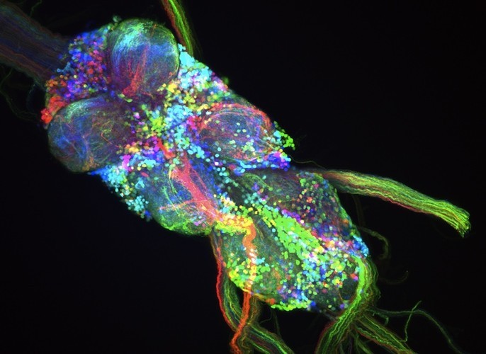  Scientists Turn Fly Neurons Into Gorgeous Art Using technology affectionately dubbed