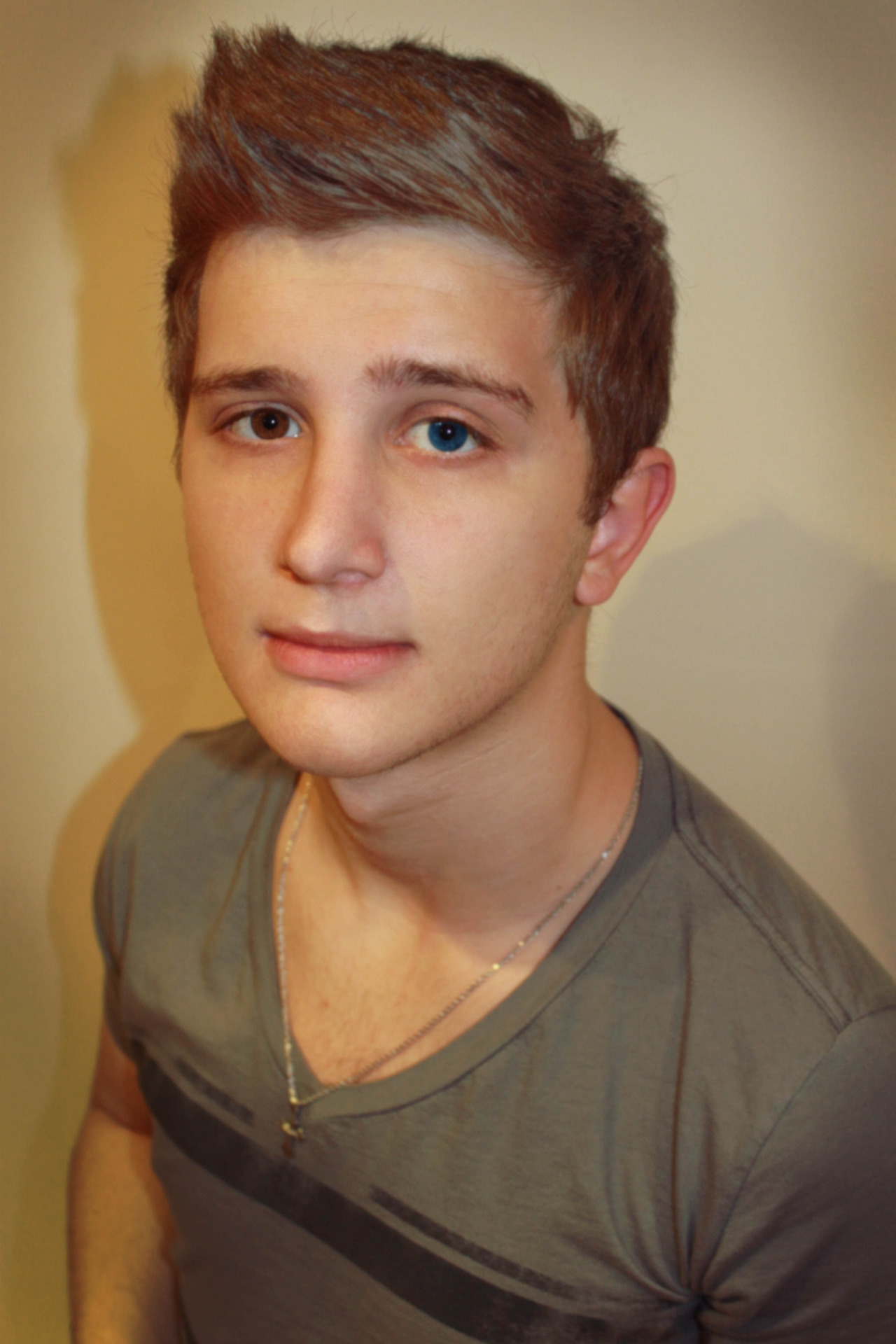 book-0f-eli:  skate-high:  Heterochromia. A condition where one eye is a complete