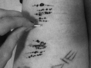 Sólo Verlo Me Duele :/ No Sé, No Sé&Amp;Hellip; ¿Pensarás Un Poco Antes De Hacer
