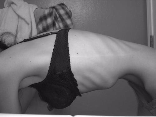 psychotic-torture:  sad black and white blog, I follow back similar
