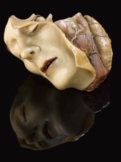 catafalques:  Wax model of a female human head, Germany, 1801-1900  Complete with eyelashes, this remarkably life-like wax head has been cut away to show the skull and the muscles of the eye, face and neck. Wax models were used for teaching anatomy to