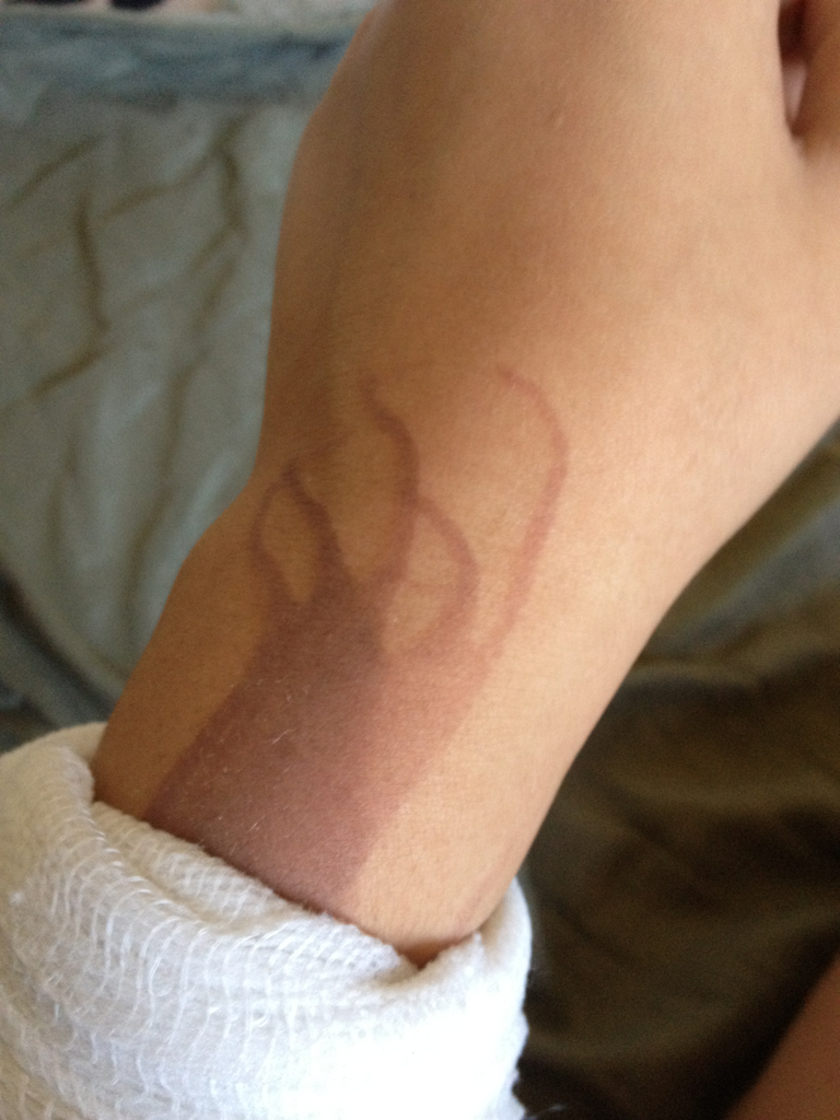 o-ldie:  What I get for trying to cook bacon…looks cool as fuck though
