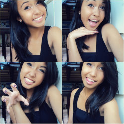 shy-raaw:  bye bye braces :3  