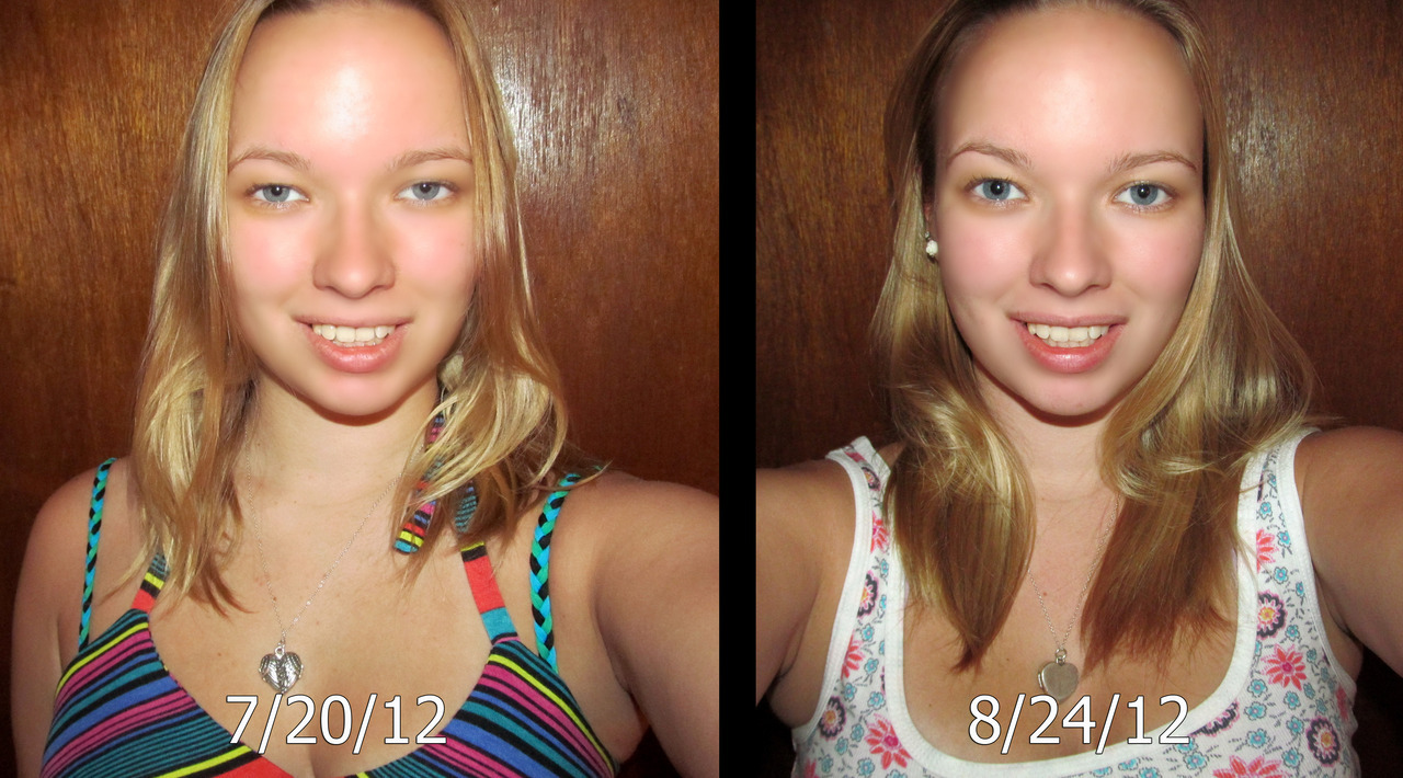 CATRINA — So the first pic is me, before starting biotin,...