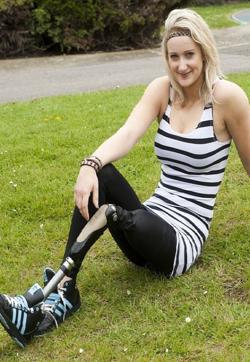 Amy Conroy 19 year old LAK wheelchair basketballer from the UK.  She lost the leg at 13.