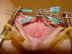 BDSM, a different view of one that I have posted before. Pussy lips sewn to metal restraints, clit clamped, then several needles pushed through.