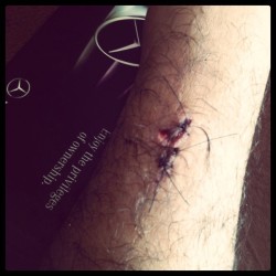 Yummmy #stitches  (Taken with Instagram)