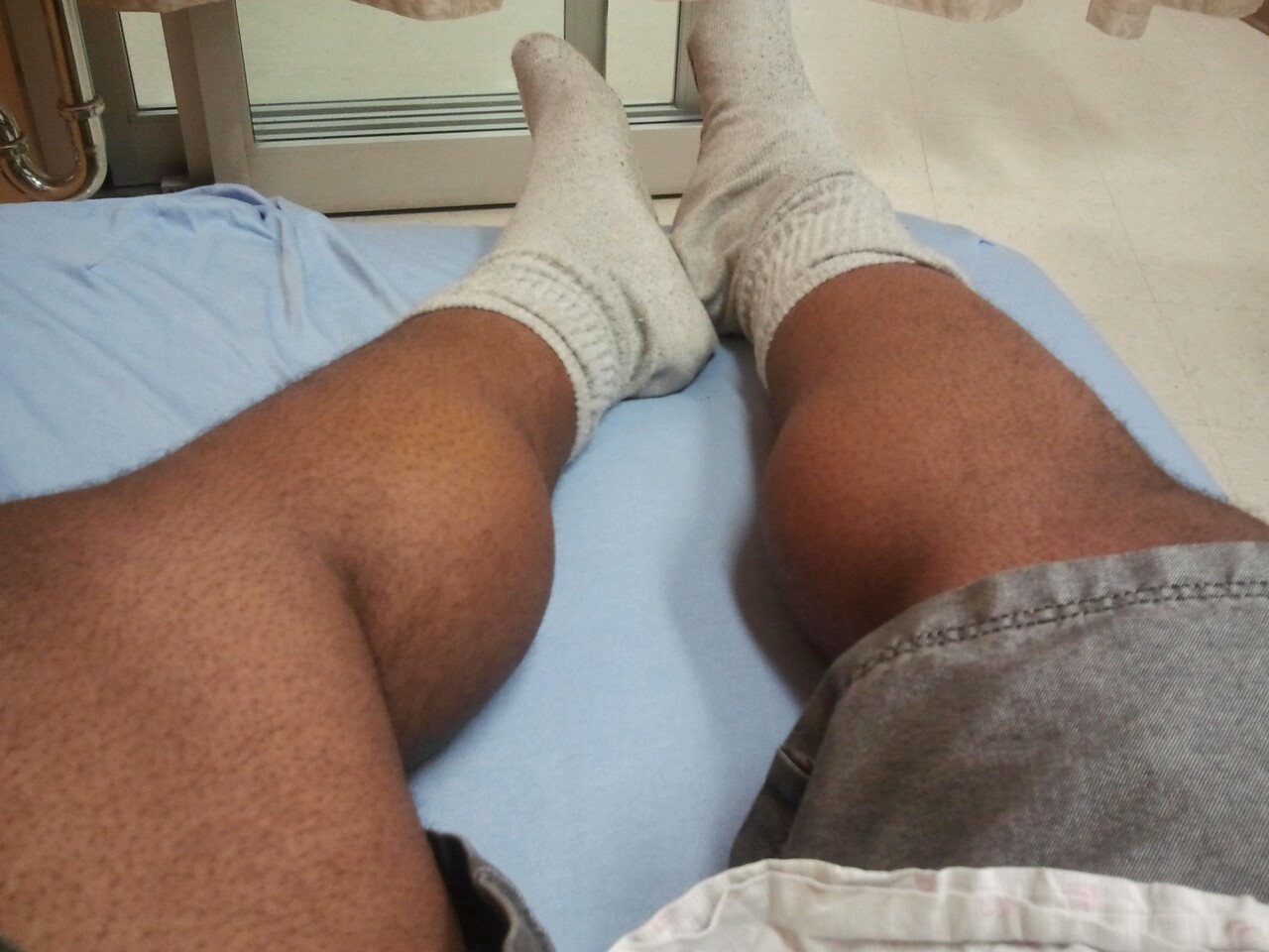 Meanwhile in the hospital&hellip;  Are my calves sexy are what!?