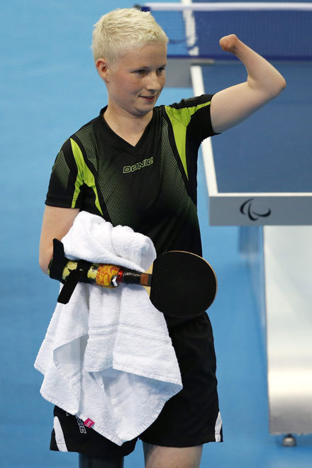 Here are some photos of German Paralympic table tennis player Stephanie.  She is is missing bot