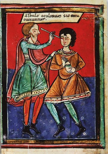 collective-history:  Eye surgery in the Middle Ages ca. 1195 (via)  That looks beyond painful.&