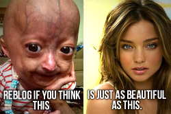mariomush:  owlmylove:  You know what? No. No, I do not think that girl is as beautiful as the woman on the right. And before you social justice bloggers come stampeding into my askbox, wondering how I could be such a heartless, bitch- hear me out. The