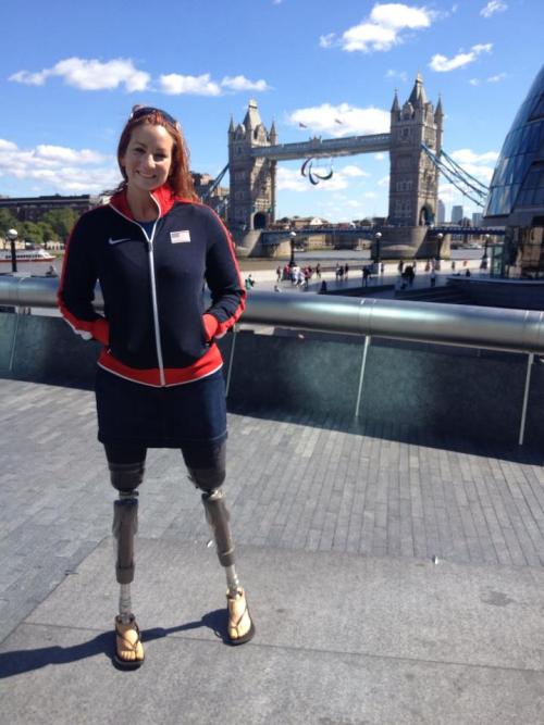 fyprosthetics:Paralympian Katy Sullivan Flip-flops on prosthetic feet=Cute City.Would it be too 