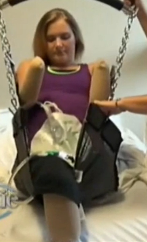 Quad amputee