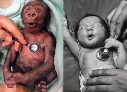  A gorilla, and a human baby reacting to the coldness of the stethoscope exactly the same way. 