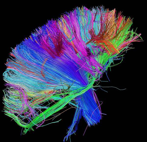 A brain scan of white matter fibers, color-coded by direction. (Courtesy of the Laboratory of Neuro Imaging at UCLA and Martinos Center for Biomedical Imaging at MGH www.humanconnectomeproject.org / September5, 2012)