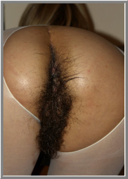 hairywomenrock:  Hairy back=side!!!