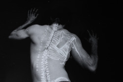 victimize:  “The Body,” a series by Alan