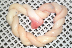 i-eviscerate:  Umbilical cord twisted into the shape of a heart.  