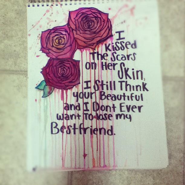 lipglosssmileandscrapedupknees:  &lt;3 