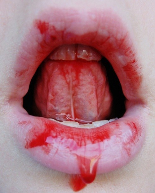  cannedmermaidmeat.tumblr.com after 