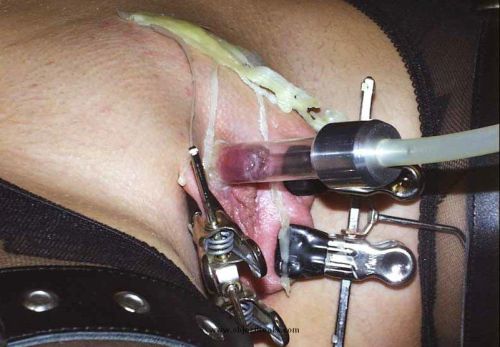 Sex BDSM. Labia clamped, clit vacuum pumped up pictures