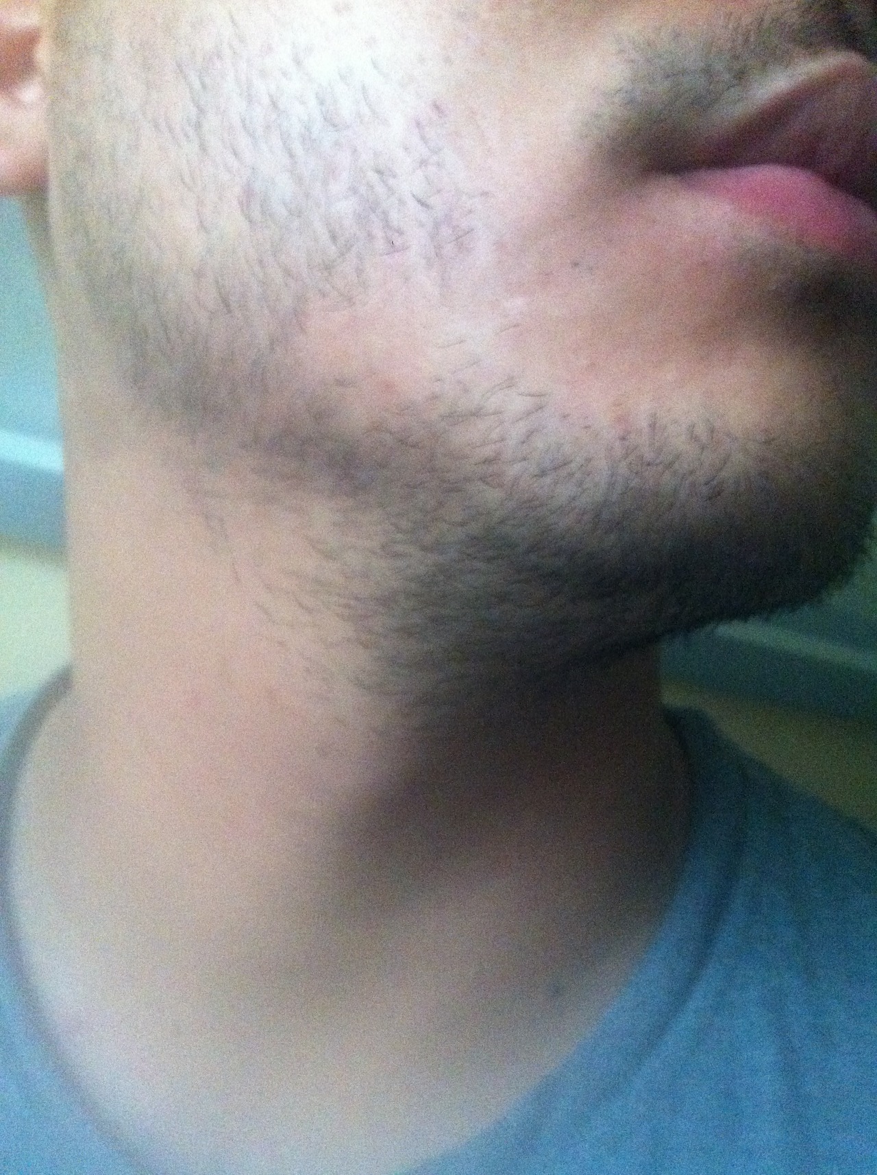 dub chin comin in