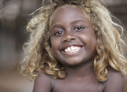 louimmortality:  The Melanesian children - naturally blonde hair & dark skin 