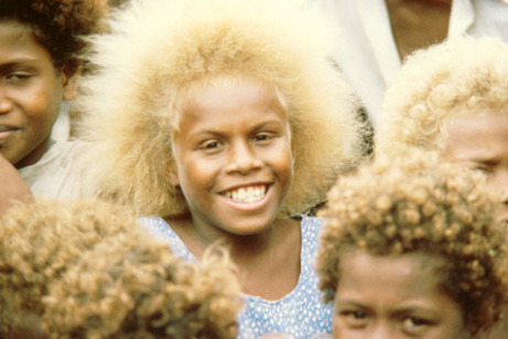 louimmortality:  The Melanesian children - naturally blonde hair & dark skin 