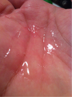 idschlicktothat:  This is some cum I got on my hand after playing ;)