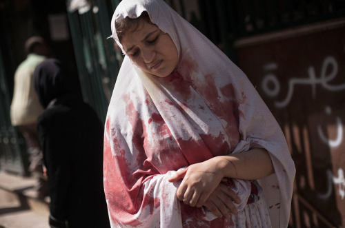 A wounded woman in Aleppo, Syria. Source: www.theatlantic.com/infocus/2012/10/destruction-com