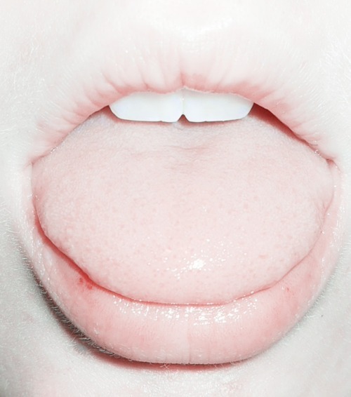 scar-ed:  ♡ 