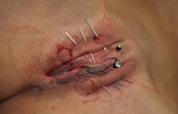 pussymodsgalore  BDSM pain games, needles