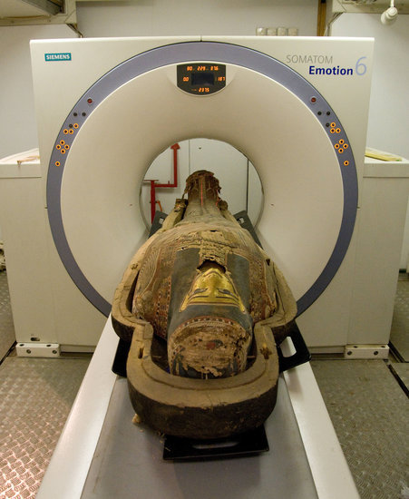snowyarcherprince:kingchestnutsroastinonanopenfire:Sir we got the MRI scan report back in… the good 