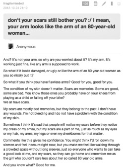 my-beloved-scars:  fragileminded:  Rebloggable by request.   This is fucking amazing. No one should ever e ashamed of their scars. I’m so glad that someone feels the same way as I do. People always notice the scars before they notice the person themself.