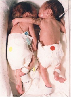 hachedesilencio:  Esta foto es de un artículo llamado “el abrazo salvador”. El artículo detalla la primera semana de vida, de dos gemelos. Cada uno estaba en su propia incubadora, y uno de ellos no se esperaba que viviera. Una enfermera peleó contra