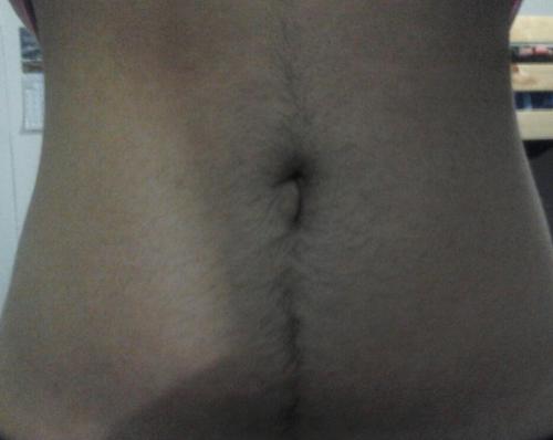 johnnysonline: closet-hirsute:  my hairy tummy. believe me it looks much worse in person.   Sex