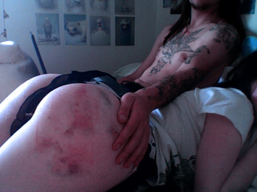 ass bruises are my fav. porn pictures