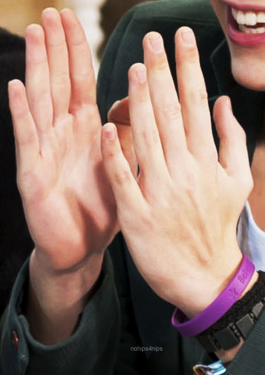 Let's examine Harry's hands...