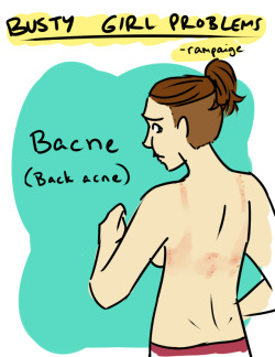 bustygirlcomics:  Zit’s a pain.