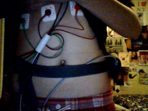 holter monitor