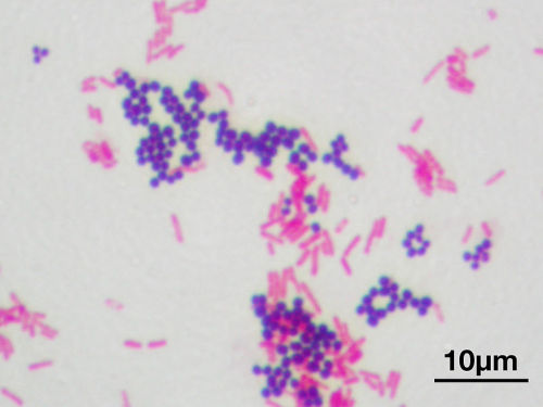 medicinenotes:Gram staining (or Gram’s method) is a method of differentiating bacterial species into