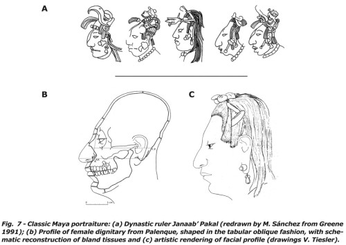 scientificillustration:Classic Maya cranial modificationFrom: Studying cranial vault modifications i