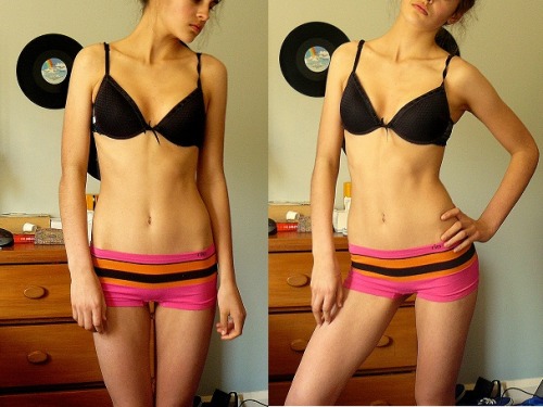 thinlikeaskeleton:  new underwear! 