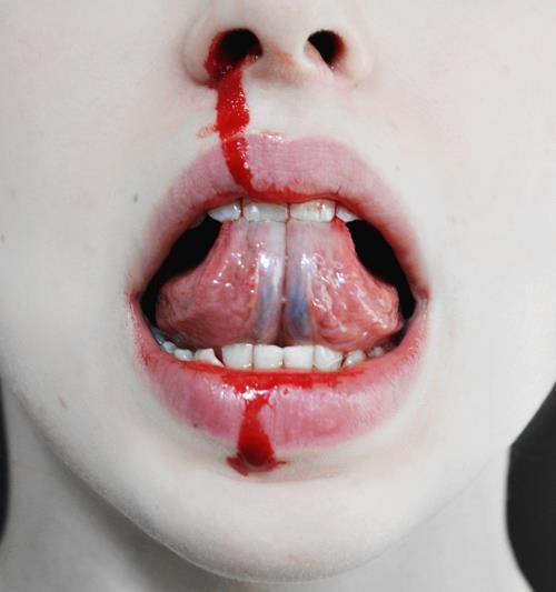 chrislittlerat:bloody teeth 